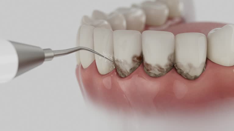 Trusted Teeth Cleaning And Checkup service in South Greensburg, PA - Dentist Open Now